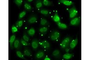 Immunofluorescence analysis of MCF7 cells using DR1 Polyclonal Antibody (DR1 Antikörper)