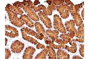 Immunohistochemistry (IHC) image for anti-Mucin 5AC, Oligomeric Mucus/gel-Forming (MUC5AC) antibody (ABIN3025263)