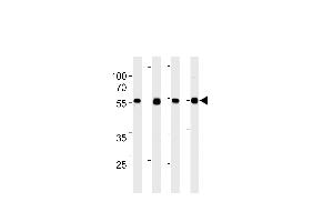 TPIPb Antibody (C-term) ABIN1882284 western blot analysis in 293,A431,,mouse NIH/3T3 cell line lysates (35 μg/lane).