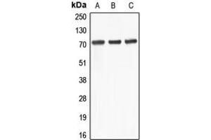 Western blot analysis of ABCD4 expression in Jurkat (A), Raji (B), THP1 (C) whole cell lysates.