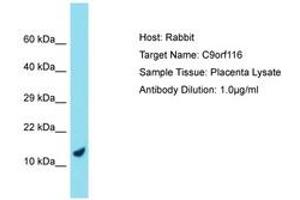 Image no. 1 for anti-Chromosome 9 Open Reading Frame 116 (C9ORF116) (AA 39-88) antibody (ABIN6750756) (C9ORF116 Antikörper  (AA 39-88))