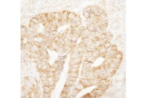anti-RpL7a/SURF3 (C-Term) antibody