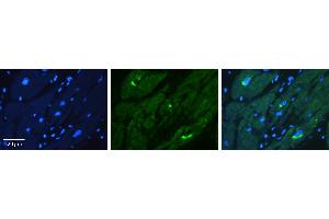 Rabbit Anti-KAT5 Antibody Catalog Number: ARP38792_P050 Formalin Fixed Paraffin Embedded Tissue: Human heart Tissue Observed Staining: Cytoplasmic Primary Antibody Concentration: 1:100 Other Working Concentrations: 1:600 Secondary Antibody: Donkey anti-Rabbit-Cy3 Secondary Antibody Concentration: 1:200 Magnification: 20X Exposure Time: 0.
