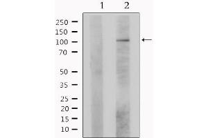 Western Blotting (WB) image for anti-Ligase IV, DNA, ATP-Dependent (LIG4) (C-Term) antibody (ABIN6262967)