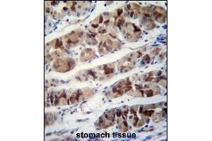 PCIA1 Antibody (Center) (ABIN658015 and ABIN2846953) immunohistochemistry analysis in formalin fixed and paraffin embedded human stomach tissue followed by peroxidase conjugation of the secondary antibody and DAB staining. (DDA1 Antikörper  (AA 11-40))