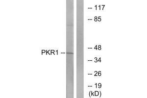 Western blot analysis of extracts from COLO cells, using PKR1 antibody. (Prokineticin Receptor 1 Antikörper  (N-Term))