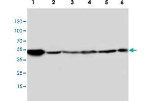 Western blot analysis of tissue and whole cell extracts with HTR2A polyclonal antibody . (HTR2A Antikörper  (C-Term))