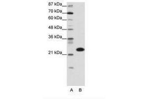 Image no. 1 for anti-TATA Box Binding Protein Associated Factor 11 (TAF11) (N-Term) antibody (ABIN6736151)