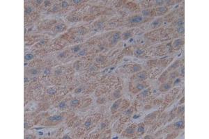 IHC-P analysis of liver tissue, with DAB staining. (ACADL Antikörper  (Lys430))