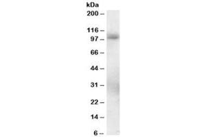 Western blot testing of human lung lysate with PDE5 antibody at 0. (PDE5A Antikörper)