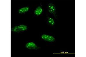 Image no. 1 for anti-LIM Homeobox 1 (LHX1) (AA 1-101) antibody (ABIN598782) (LHX1 Antikörper  (AA 1-101))