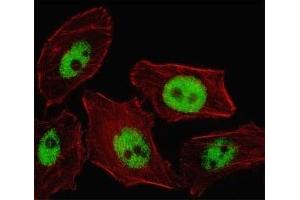 Fluorescent image of U251 cell stained with PHOX2B antibody. (PHOX2B Antikörper  (AA 104-130))
