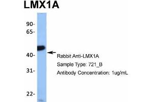 Host: Rabbit  Target Name: TRIM10  Sample Tissue: 721_B  Antibody Dilution: 1. (LMX1A Antikörper  (Middle Region))