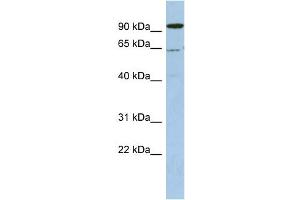 WB Suggested Anti-DDX52 Antibody Titration:  0. (DDX52 Antikörper  (N-Term))