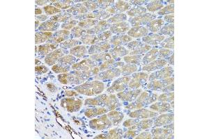 Immunohistochemistry of paraffin-embedded mouse stomach using VPS37A antibody. (VPS37A Antikörper)