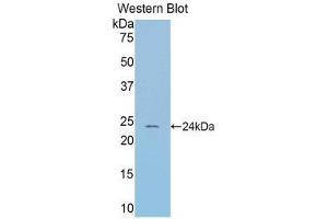Western Blotting (WB) image for anti-serpin Peptidase Inhibitor, Clade A (Alpha-1 Antiproteinase, Antitrypsin), Member 6 (SERPINA6) (AA 57-256) antibody (ABIN1858267) (SERPINA6 Antikörper  (AA 57-256))