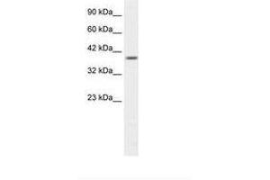 Image no. 1 for anti-Proteasome (Prosome, Macropain) 26S Subunit, Non-ATPase, 14 (PSMD14) (N-Term) antibody (ABIN202214) (PSMD14 Antikörper  (N-Term))