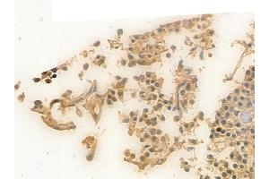 ABIN6256550 and ABIN6267640 at 1/100 staining human pituitary adenoma by IHC-P. (eIF4EBP1 Antikörper  (pThr36))