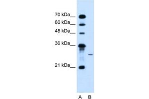 Western Blotting (WB) image for anti-1-Acylglycerol-3-Phosphate O-Acyltransferase 2 (Lysophosphatidic Acid Acyltransferase, Beta) (AGPAT2) antibody (ABIN2463969) (AGPAT2 Antikörper)