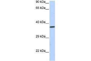 WB Suggested Anti-SCML1 Antibody Titration:  0. (SCML1 Antikörper  (N-Term))
