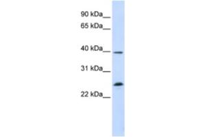 Western Blotting (WB) image for anti-Single-Stranded DNA Binding Protein 2 (SSBP2) antibody (ABIN2460285) (SSBP2 Antikörper)