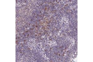 Immunohistochemical staining (Formalin-fixed paraffin-embedded sections) of human lymph node with CD1E polyclonal antibody  shows moderate cytoplasmic positivity in subset of non-germinal center cells.