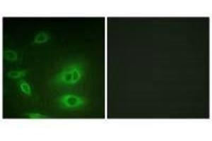 Immunofluorescence analysis of HeLa cells, using ATP1α1/Na+K+ ATPase1 (Ab-23) antibody. (ATP1A1 Antikörper  (Ser23))