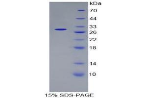 SDS-PAGE (SDS) image for DNA Repair Protein Complementing XP-G Cells (ERCC5) (AA 778-986) protein (His tag) (ABIN2127266) (ERCC5 Protein (AA 778-986) (His tag))
