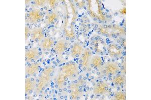 Immunohistochemistry of paraffin-embedded mouse kidney using CYP4A11 antibody at dilution of 1:100 (40x lens). (CYP4A11 Antikörper)