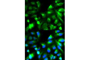 Immunofluorescence analysis of HeLa cell using SNAP25 antibody. (SNAP25 Antikörper)