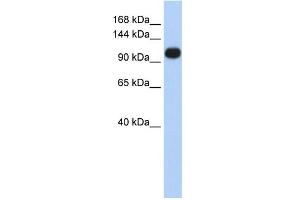 WB Suggested Anti-ATP2A3 Antibody Titration:  0. (ATP2A3 Antikörper  (Middle Region))