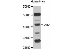 Western blot analysis of extracts of mouse brain, using OMD antibody (ABIN6290709) at 1:1000 dilution. (Osteomodulin Antikörper)