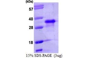 SDS-PAGE (SDS) image for Nanog Homeobox (NANOG) (AA 1-154) protein (His tag) (ABIN667930) (Nanog Protein (AA 1-154) (His tag))