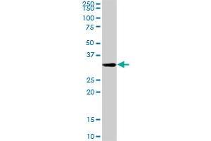 HADHSC MaxPab rabbit polyclonal antibody. (HADH Antikörper  (AA 1-314))