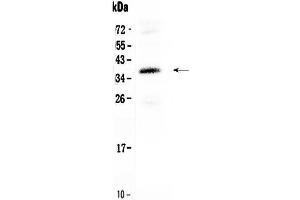 Western blot analysis of CORD2 using anti-CORD2 antibody .