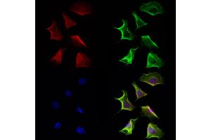 ABIN6264546 and ABIN6272948 staining Hela cells by IF/ICC. (QSOX1 Antikörper  (Internal Region))