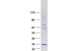 Validation with Western Blot (CHTF8 Protein (Transcript Variant 1) (Myc-DYKDDDDK Tag))