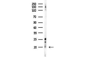 anti-Transmembrane Protein 37 (TMEM37) (N-Term) antibody