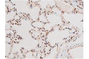 ABIN6267601 at 1/200 staining Rat lung tissue sections by IHC-P. (NF-kB p65 Antikörper  (pThr435))