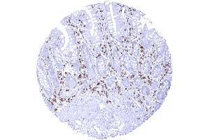 Strong CD5 immunostaining of T lymphocytes in the ileum mucosa (Rekombinanter CD5 Antikörper  (AA 32-372))