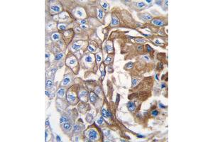 Immunohistochemistry (IHC) image for anti-GTPase NRas (NRAS) antibody (ABIN3003468) (GTPase NRas Antikörper)