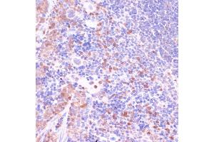 Immunohistochemistry of paraffin-embedded mouse spleen using UGT2B15 antibody (ABIN7271194) at dilution of 1:100 (40x lens). (UGT2B15 Antikörper  (AA 60-190))