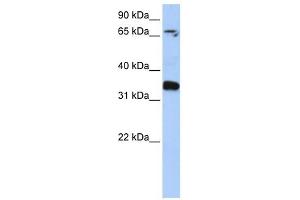 GLE1 antibody used at 1 ug/ml to detect target protein. (GLE1 Antikörper)