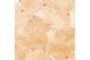 Immunohistochemical anyalysis of mouse skeletal muscle tissue with PRC1 polyclonal antibody  at 2. (PRC1 Antikörper  (Internal Region))