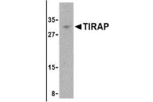 Image no. 1 for anti-Toll-Interleukin 1 Receptor (TIR) Domain Containing Adaptor Protein (TIRAP) (Middle Region) antibody (ABIN265135) (TIRAP Antikörper  (Middle Region))