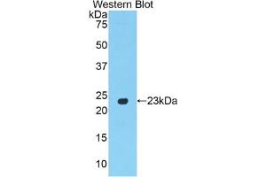 Western blot analysis of the recombinant protein. (PPARG Antikörper  (AA 311-493))
