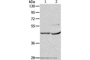 Western blot analysis of Mouse kidney and heart tissue, using NCEH1 Polyclonal Antibody at dilution of 1:1350 (NCEH1 Antikörper)