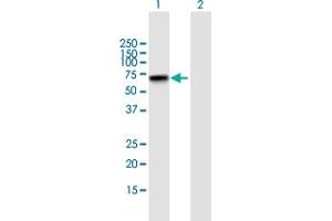 Zinc Finger Protein 296 (ZNF296) (AA 1-475) Antikörper