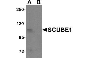 Western Blotting (WB) image for anti-Signal Peptide, CUB Domain, EGF-Like 1 (SCUBE1) (Middle Region) antibody (ABIN1031082) (SCUBE1 Antikörper  (Middle Region))