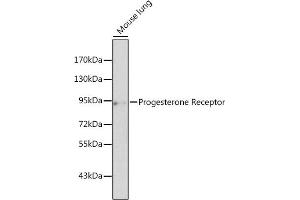 Western blot analysis of extracts of mouse lung, using Progesterone Receptor antibody (ABIN3022926, ABIN3022927, ABIN3022928 and ABIN6219301) at 1:500 dilution. (Progesterone Receptor Antikörper  (C-Term))